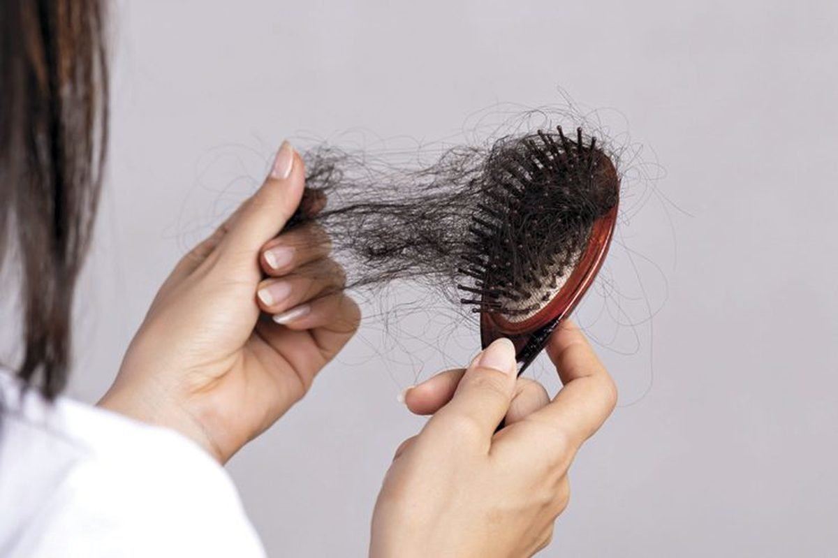 بهترین روش جلوگیری از ریزش مو